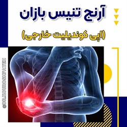 آرنج تنیس‌بازان ( اپی کوندیلیت خارجی)